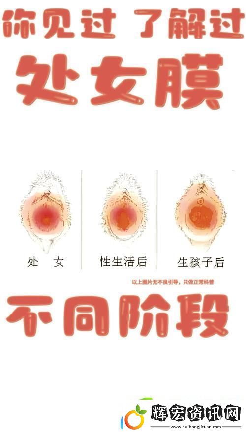 勇敢迎接生活的轉折——“處破女處破全過第一次”的心路歷程