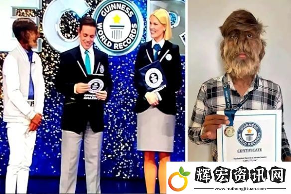 印度少年獲“最毛臉”吉尼斯紀錄